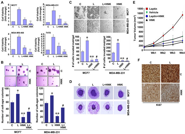 Honokiol diminishes the stimulatory effect of leptin on cell viability, anchorage-independent growth, invasion, migration and breast tumor growth in nude mice.