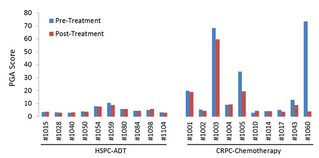 Plasma genomic abnormality (PGA) scores in 20 patients with advanced prostate cancer.