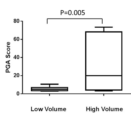 PGA score differences between high and low volume prostate cancer patients (see main text for definition).