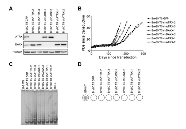 Depletion of ATRX does not induce ALT in epithelial cells.