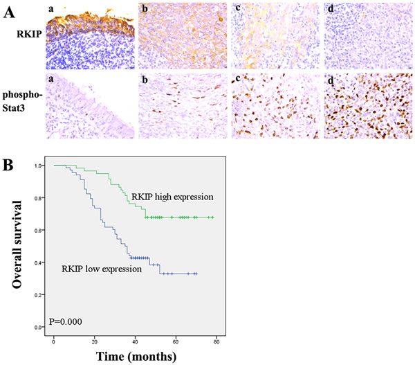 Association of RKIP expression levels with NPC metastasis and overall survival of the patients.