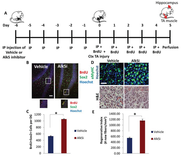 Simultaneous Partial Rescue of Hippocampal Neurogenesis and Myogenesis in Aged Mice through Systemic In vivo inhibition of TGF-&#x03B2;.