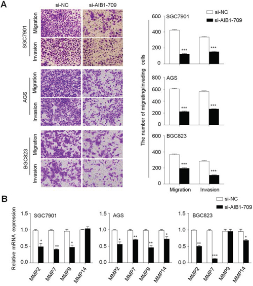 Inhibition of gastric cancer cell migration and invasion by AIB1 down-regulation.