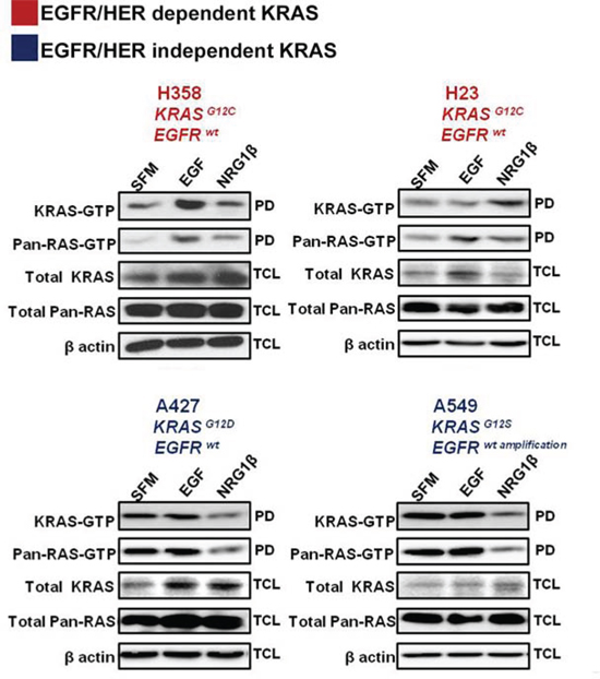Effects of acute growth factor stimulation on RAS activity in mutant KRAS NSCLC cells.