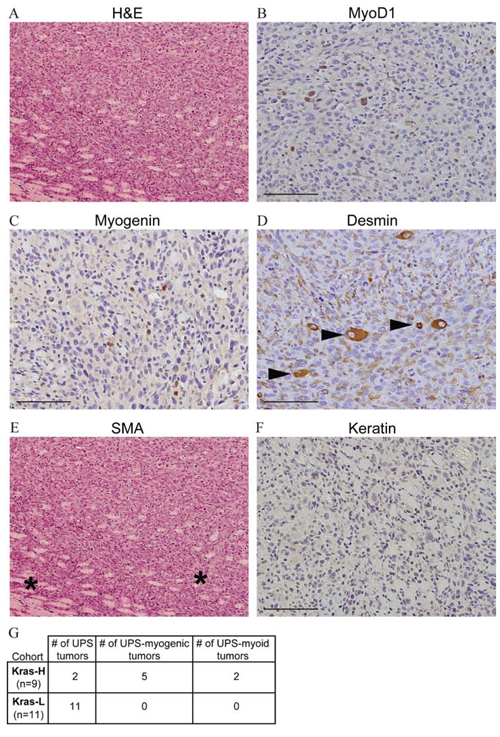 Generation of high-grade sarcomas with myogenic differentiation using mosaicism.