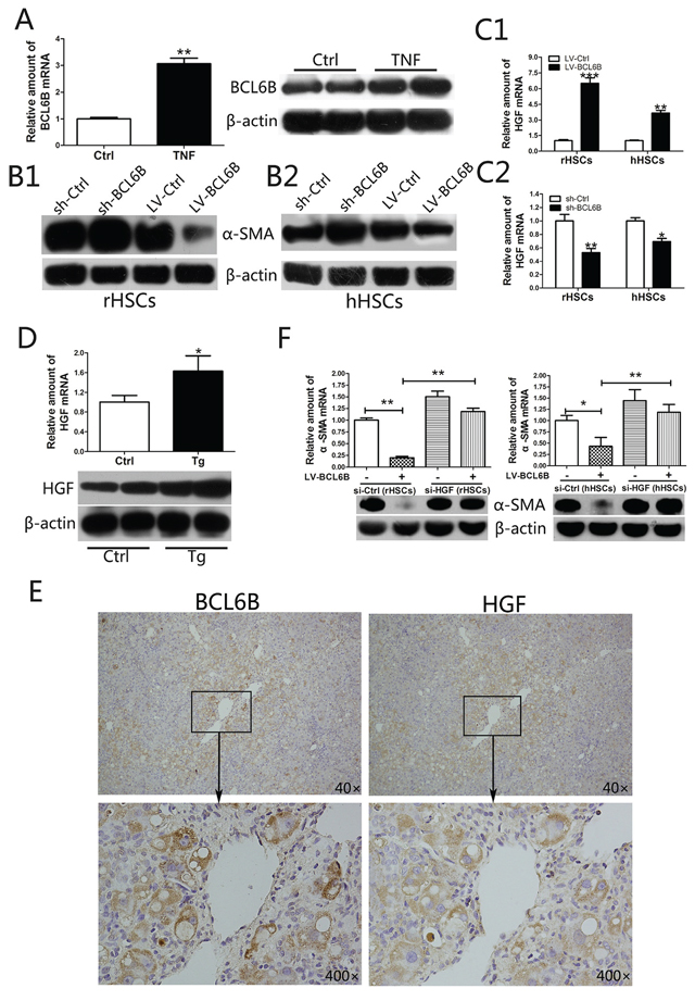 BCL6B inhibits the activation of hepatic stellate cells (HSCs) through regulation of hepatocyte growth factor (HGF).