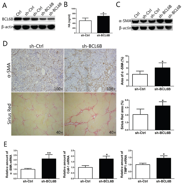 Inhibition of BCL6B expression in the liver aggravates liver fibrosis.