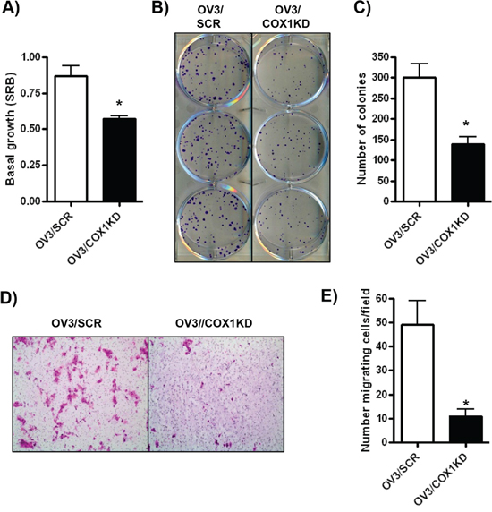 COX-1 knockdown in ovarian cancer cells promotes an anti-tumorigenic cellular phenotype.