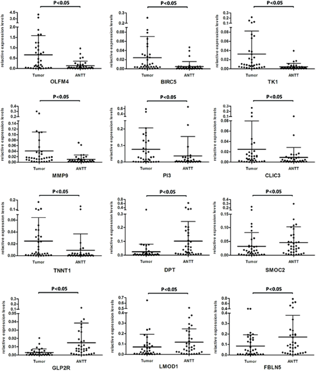 Expression levels of twelve DEGs in paired GBC tissues and ANTTs respectively.