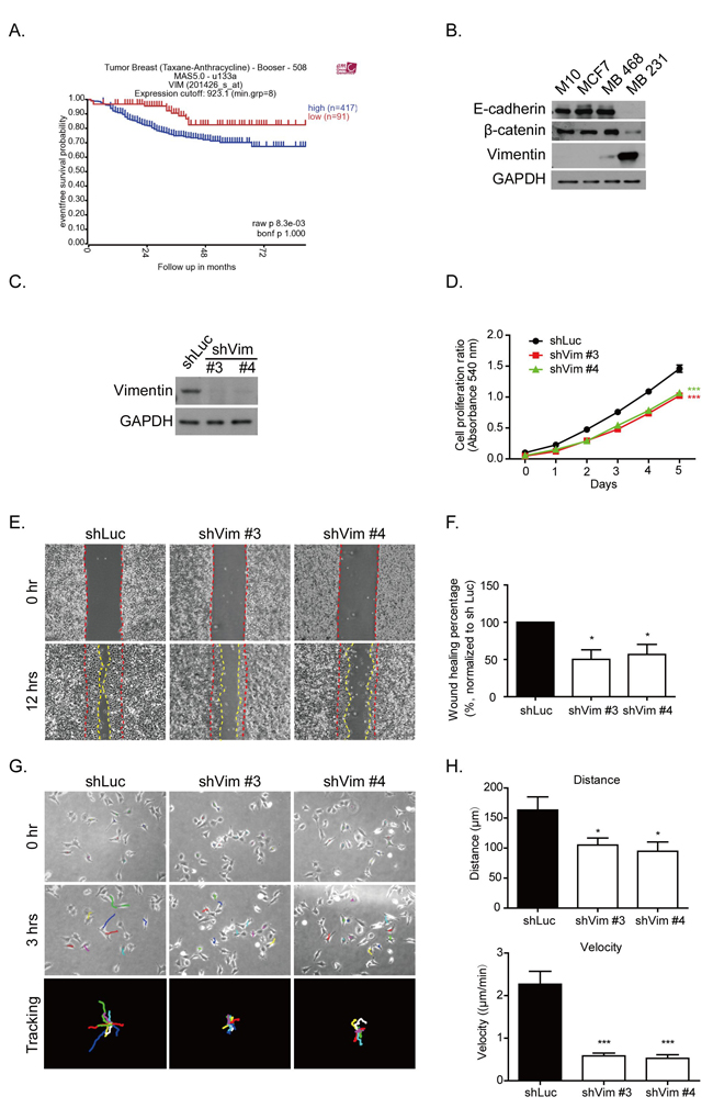 Vimentin expression contributes to breast cancer malignancy.