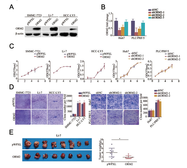 ORM2 inhibited HCC cell growth