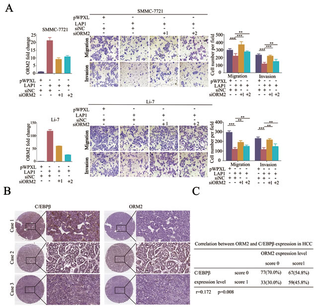 LAP1 represses HCC cell migration and invasion by inducing ORM2 expression.