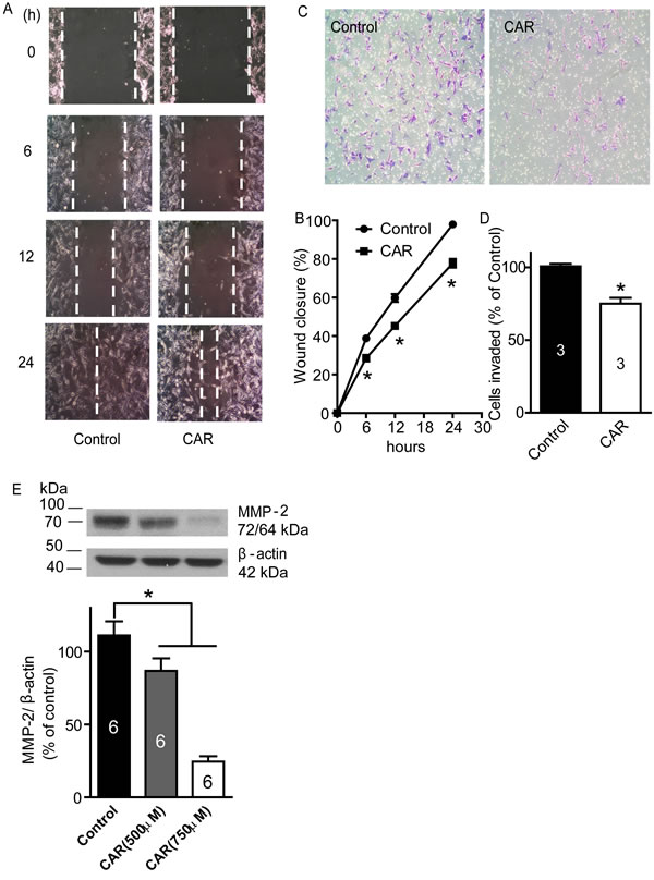 Carvacrol inhibited U87 cell migration, invasion and MMP-2 protein expression.