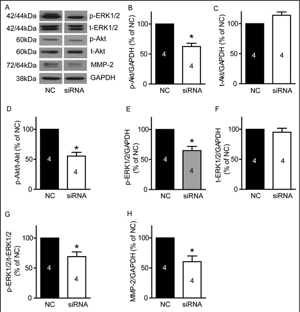 TRPM7 silencing reduced p-Akt, p-ERK1/2 and MMP-2 protein levels in U87 cells.