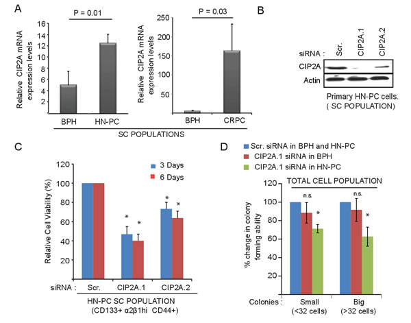 CIP2A is overexpressed and promotes growth and viability of cancer stem-like cell (SC) population from patient-derived prostate epithelial cell (PPECs) cultures.
