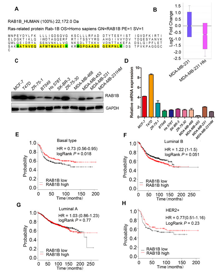 RAB1B is down-regulated in highly metastatic breast cancer cells.