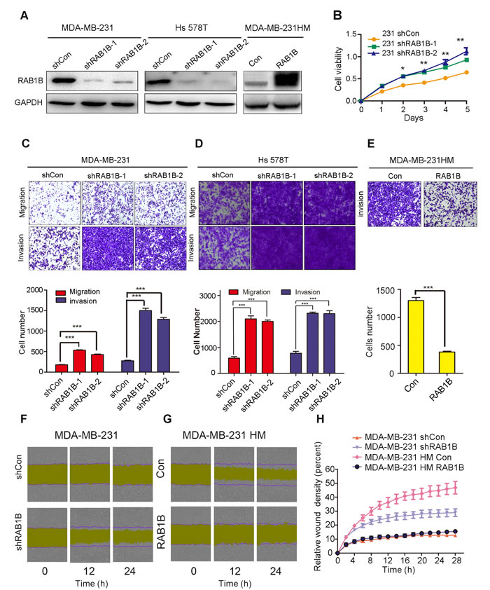 Low RAB1B expression promotes breast cancer metastasis