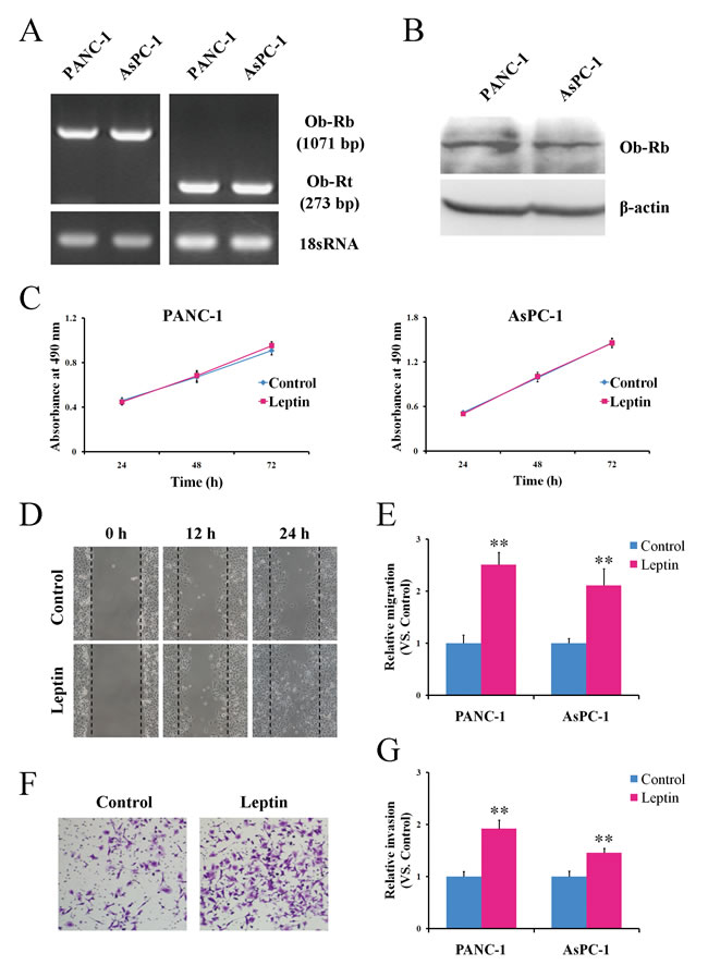 Leptin promotes the migration and invasion potential of human pancreatic cancer cells