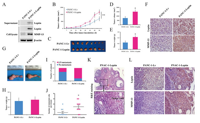 Leptin promotes tumor growth and metastasis to the lymph nodes in mouse models of human pancreatic cancer.