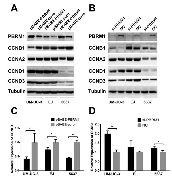 PBRM1 suppresses cyclin B1 expression in bladder cancer cell.