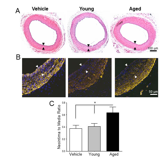 Monocytes from aged rats exacerbate post-injury neointimal hyperplasia in young arteries.