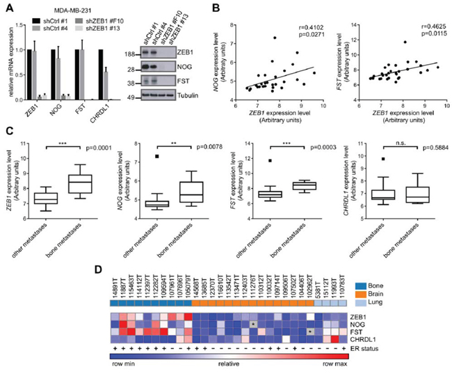 The expression of ZEB1 and BMP-inhibitors correlates with breast cancer bone metastasis.