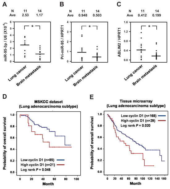 Decreased expression of miR-95-3p and ABLIM2 in brain metastatic tissue and correlation of cyclin D1 with the survival of patients with lung adenocarcinoma (ADC).