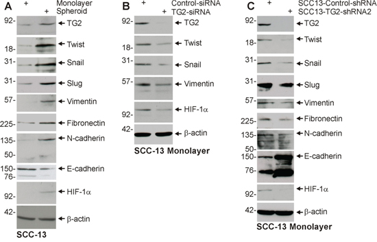 TG2 and EMT marker expression is enriched in ECS cells, and TG2 is required for EMT.