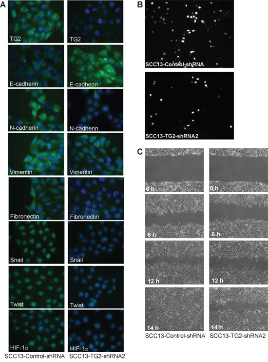 TG2 is required for EMT marker expression and invasion/migration.