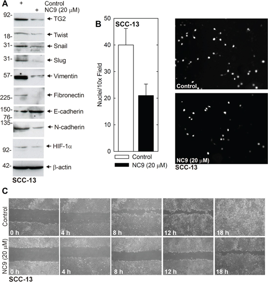 NC9 reduces EMT protein expression and invasion/migration.