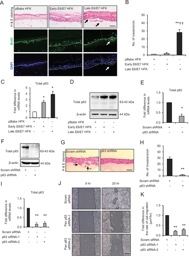 p63 transcription factors drive cell migration and invasion in late passage human foreskin keratinocytes (HFK) expressing human papilloma virus (HPV)16 E6/E7 genes.