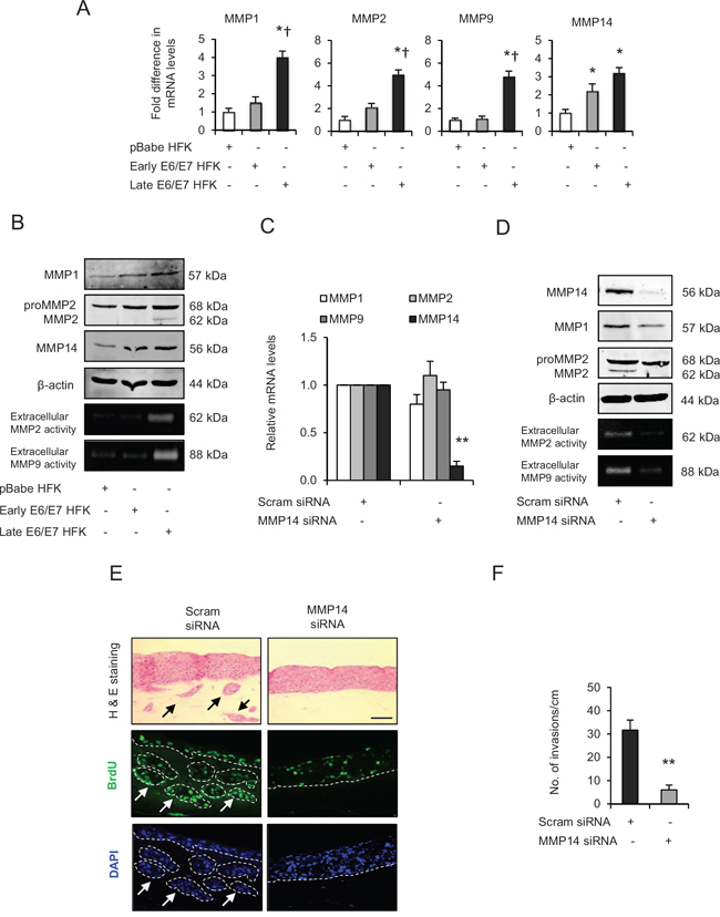 Matrix metalloproteinases (MMP)-mediated extra cellular matrix (ECM) remodelling is important during invasion.