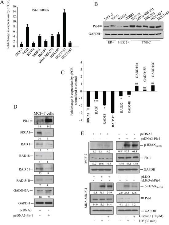 Pit-1 expression in breast tumor cell lines is linked to DNA damage response genes.