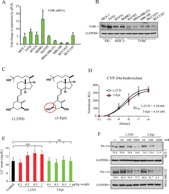 Vitamin D receptor (VDR) expression in human breast cell lines, and biological activity of the vitamin D derivative 1&#x03B1;, 25-dihydroxy-3-epi-vitamin D3 (3-Epi).