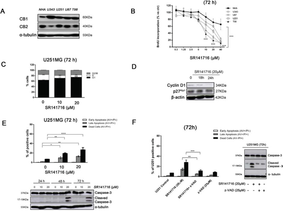 Effect of SR141716 on growth and cellular integrity of human glioma cell lines and primary astrocytes.