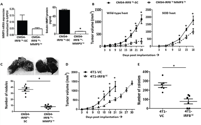 IRF8 regulates tumor behavior in an MMP3-dependent manner.