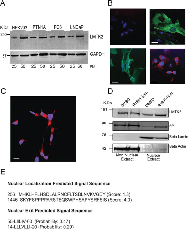 Expression and localization of LMTK2 in prostate epithelial cells.