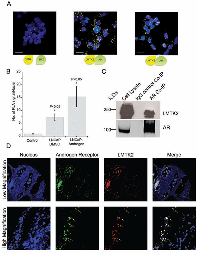 LMTK2 and AR interact in prostate cancer epithelial cells and co-localizes in human prostate tissue.