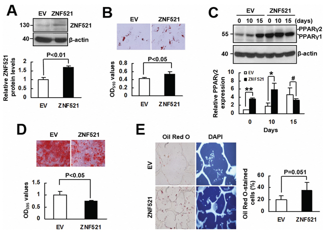 The effect of ZNF521 overexpression to the lineage differentiation of human bmMSCs.