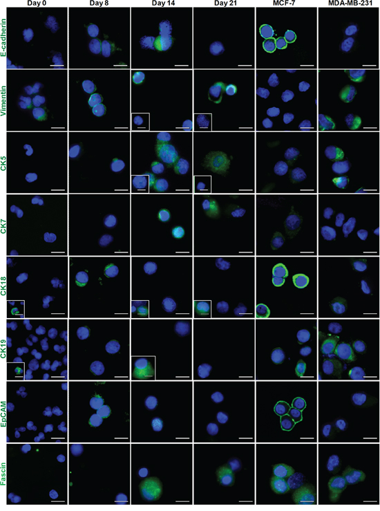 Immunostaining of epithelial and mesenchymal markers for Day 14 cultures.