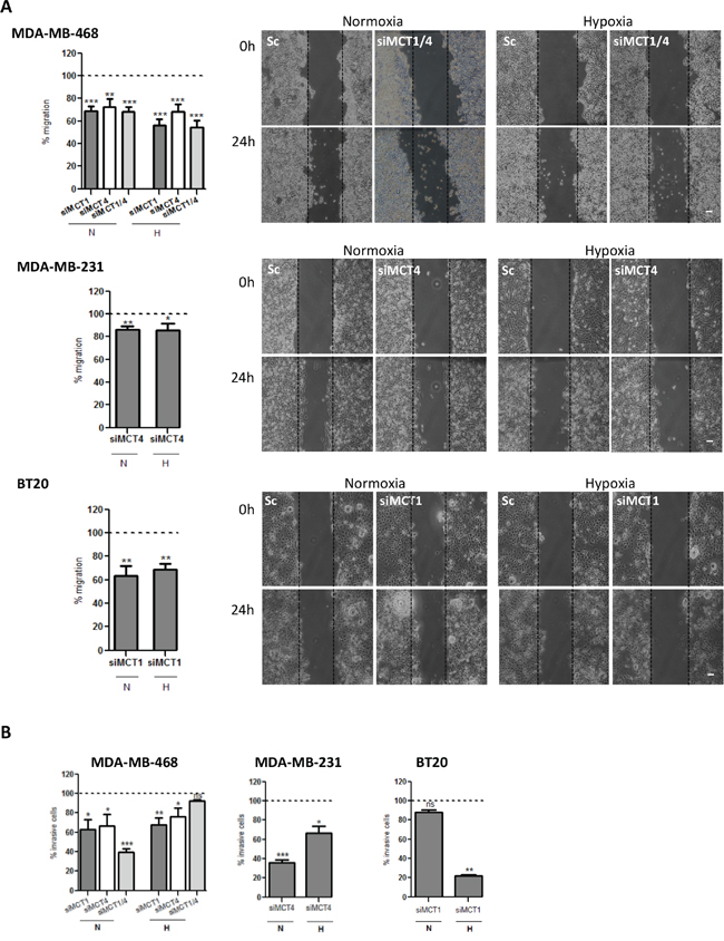 MCT knockdown decreases in vitro cell migration and invasion.