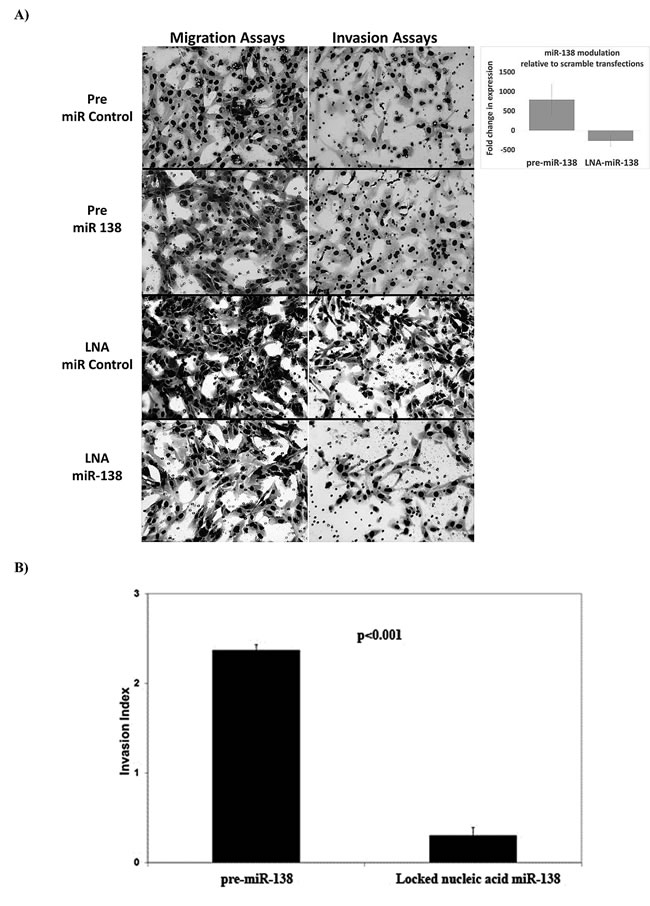 Cell morphology and invasion phenotype following miR-138 modulation.