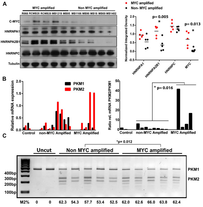 Validation of differential protein expression in independent human MB tissue samples and evidence for increased alternative splicing of PKM.