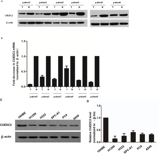 CUEDC2 is down-regulated in lung adenocarcinoma cell lines and lung adenocarcinoma tissues.