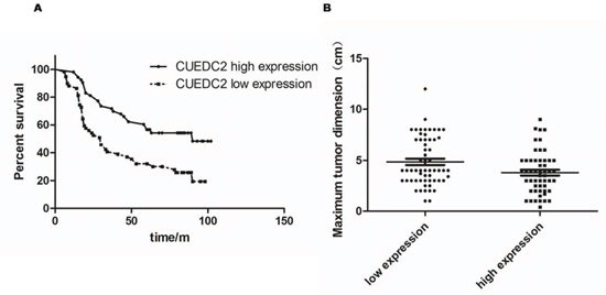 The CUEDC2 protein level affects OS.