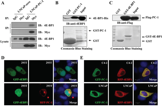 PC-1 directly interacts with 4E-BP1.