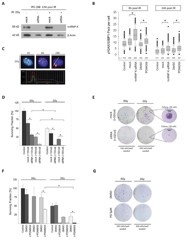 A. Immunoblotting shows effective knockdown of hnRNP K.