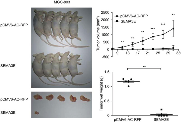 Sema3E lowered tumorigenicity of gastric cancer cell lines in vivo.