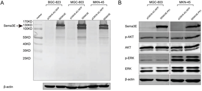 The full-length Sema3E protein exerted an inhibitory effect on gastric cancer cell lines.