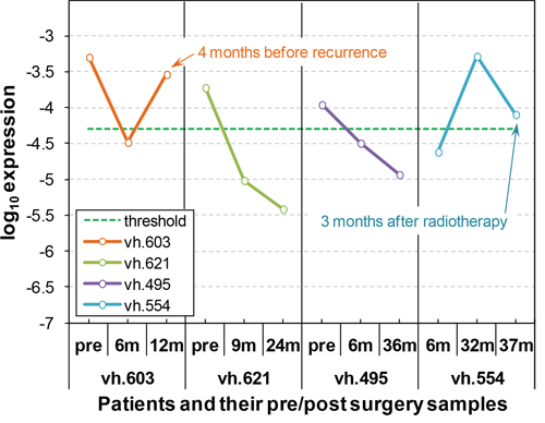 AKAP4 is a circulating biomarker for NSCLC disease monitoring and early detection of recurrence.